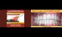 Remove dark pigmentation gums subliminal